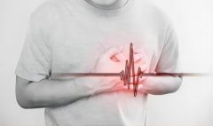 NOPAYǮ���Ƽ�