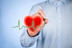 NOPAYǮ���Ƽ�